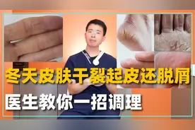 到了冬天皮肤干裂起皮还脱屑，三个病因需重视！医生教你如何缓解视频封面