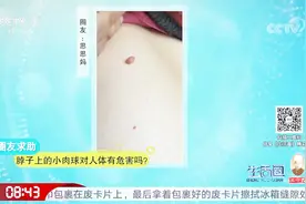 脖子上长的小肉球到底是什么？专家给出答案，想去除太简单了视频封面