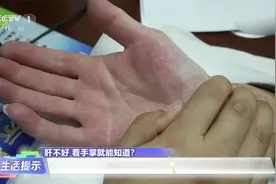 肝脏好不好看手就知道视频封面