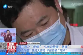 脸上小“疙瘩”没在意，最终竟成大肿物？老人小半边脸被“吞噬”视频封面