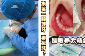 孩子出现“双排牙”，该不该拔？父母没处理好，会毁掉孩子颜值视频封面