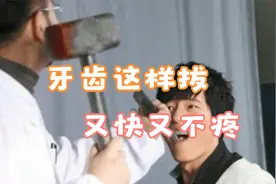 新型微创拔牙方法3D动画演示全过程！拔牙这样拔，拔的又快又不疼视频封面