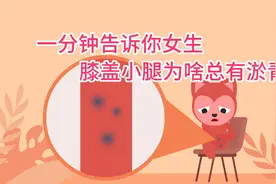 【飞碟一分钟】一分钟告诉你女生膝盖小腿为啥总有淤青视频封面
