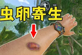虫卵钻进身体，我用骨针刺破，结果病情更严重了【绿色地狱】