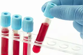 甲状腺的功能如何检查？