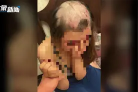 女子被丈夫剃光头拍照发网上，警方通报：男子已被行拘视频封面