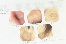 女人帮：8岁儿童竟然得了“十二指肠溃疡”？原因竟然是这个视频封面