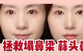 塌鼻梁和蒜头鼻的救星！2步变身高挺小巧鼻～视频封面