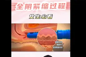 北京丽合医疗美容医院私密：茵道紧缩手术到底是怎么治疗的视频封面