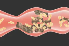 粪便发黑一定是便血吗？视频封面