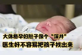 “巨型”孕妇产子，麻醉针针管不够长，好不容易在腹中找到孩子视频封面