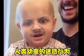 神奇：萌娃出现罕见的返祖现象，突然长出尾巴