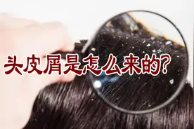 头皮屑是怎么来的？视频封面