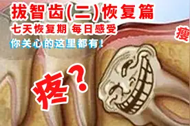 媳妇拔智齿七天恢复期每日感受，害怕拔智齿必看！关心的这里都有