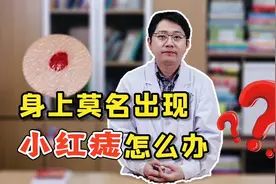 身上莫名出现小红痣，不痛不痒需要管吗？听听医生怎么说视频封面