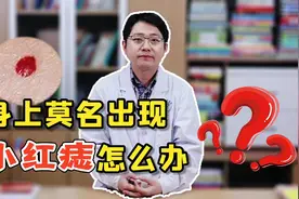 身上莫名出现小红痣，不痛不痒需要管吗？听听医生怎么说视频封面