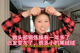 做头部锻炼操一年多，白发变灰，发量增多，发际向下移很多视频封面