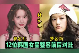 12位韩国女星整容前后对比，朴敏英判若两人，林允儿堪称整容模板