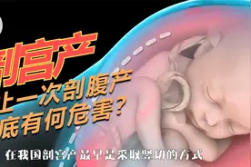 女人多次剖宫产，背后的风险你知道吗？不止一次剖宫产有何危害？视频封面