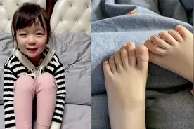 女儿长12个脚指头妈妈问要不要切掉，回答惹网友怒赞：这思想很酷视频封面