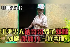 非洲男人被哥哥毁了双腿，如今腿像镰刀一样弯曲，只能爬行走路！视频封面