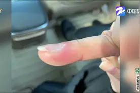 小心！ 知名演员拔倒刺竟要住院做手术视频封面