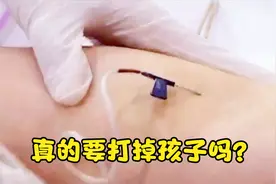 《继母后妈》医生说男人轻率受苦的是女人，但这次真的不能怪他！