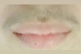 女人有了小胡子可别刮！教你去除小胡子正确方法，立马去除小胡子视频封面