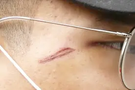 杭州：河南男子结识一位酒吧酒水销售，结账时莫名遭多人暴打