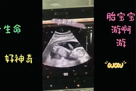 19周的胎宝宝在妈妈肚子里，活蹦乱跳，不亦乐乎视频封面