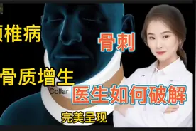医学演绎 人体颈椎病 颈椎盘突出 骨质增生 骨刺 医生是如何祛除视频封面
