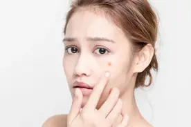 脸上反复冒痘是怎么回事？医生：3个原因要清楚，对症治疗很重要视频封面