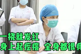 一挠就发红，身上起疙瘩，全身都很痒，医生：这是荨麻疹视频封面
