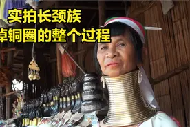 实拍长颈族，拆掉戴了一辈子的铜环，结果十分意外视频封面