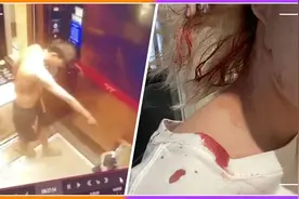 令人震怒！美女网红惨遭男友家暴堵在电梯殴打，头部撕裂血流不止视频封面