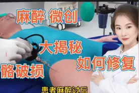 医学演绎 人体骨骼破损如何利用医学微创手术进行修复 医学揭秘视频封面