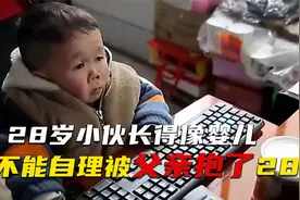28岁小伙样貌停留在婴儿时期，怎么长也长不大，生活让人心酸视频封面