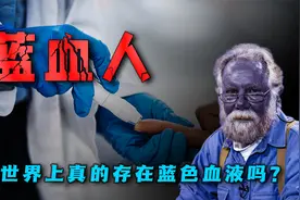 隐藏在6000米高山之上？流淌着蓝色血液，蓝血人是真实存在的吗？视频封面
