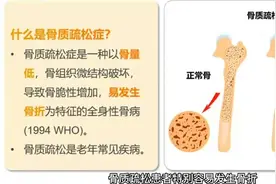 学科学 讲科学┋疫情下，骨质疏松患者应注意哪些事项视频封面