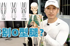 0型腿，X型腿，XO型腿，刘教练教你怎么评估视频封面