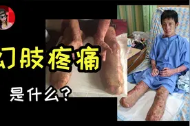 健全四肢的渴望，却带来巨大的痛苦，什么是“幻肢”视频封面