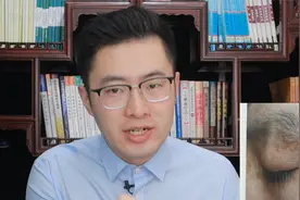 手上脸上有好多扁平小疹子，小心扁平疣！医生教你怎样快速治好它视频封面