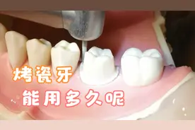 做烤瓷牙3D动画，烤瓷牙的使用寿命？烤瓷牙用了十几年要不要跟换视频封面