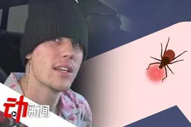 贾斯汀·比伯自曝患莱姆病：“蜱虫致残”咋回事？视频封面