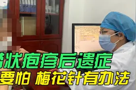 湖南大姐带状疱疹后遗症、擦泰国青草膏，医生：擦中国的清凉油视频封面