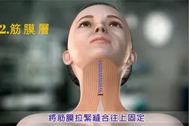 动画演示3种颈纹提升整容手术，看着特别的疼，但效果不错视频封面