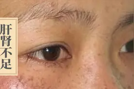 身体出现这4个症状，十有八九是肝肾不足，一定要及时补回来！