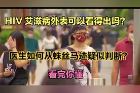 蛛丝马迹 医生如何从外表判断患者是否疑似艾滋病 真假 看完你懂