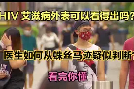 蛛丝马迹 医生如何从外表判断患者是否疑似艾滋病 真假 看完你懂视频封面