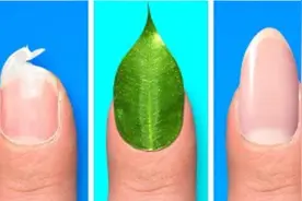 意外受伤时怎么办？分享给您几种紧急处理方式，收藏好能用到！